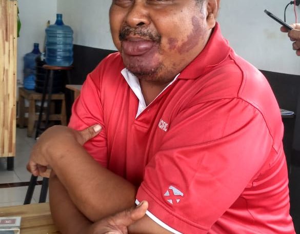 Turun ke Lapangan, Tim Monev Sering Terima Keluhan Cabor Soal Sapras